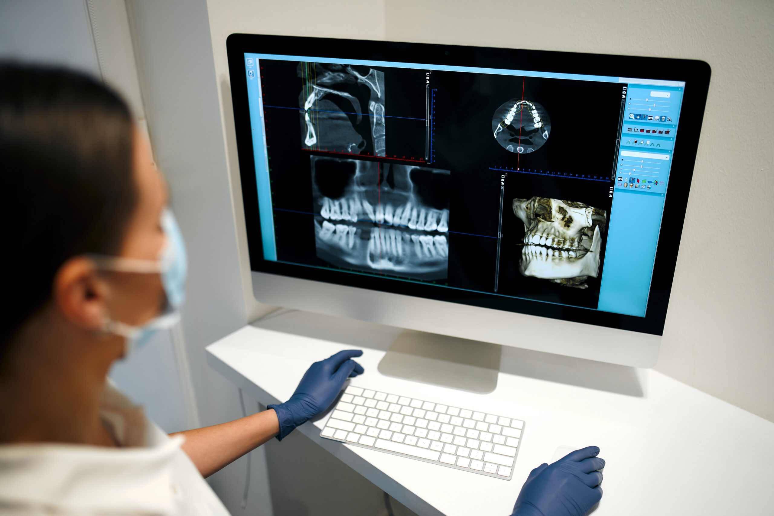 A young woman dentist in a medical mask examines an x-ray image on a computer in a dental office with modern equipment. Caries treatment. Dentistry and dental care.